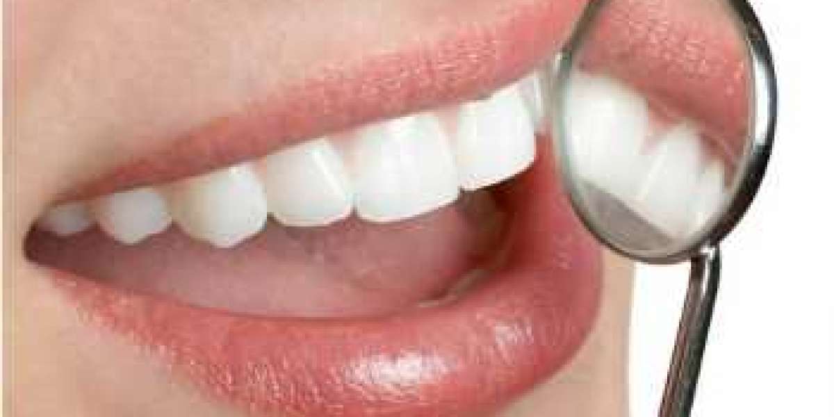 G-Force Dental Supplement Reviews - Does It Work for Teeth and Gums?