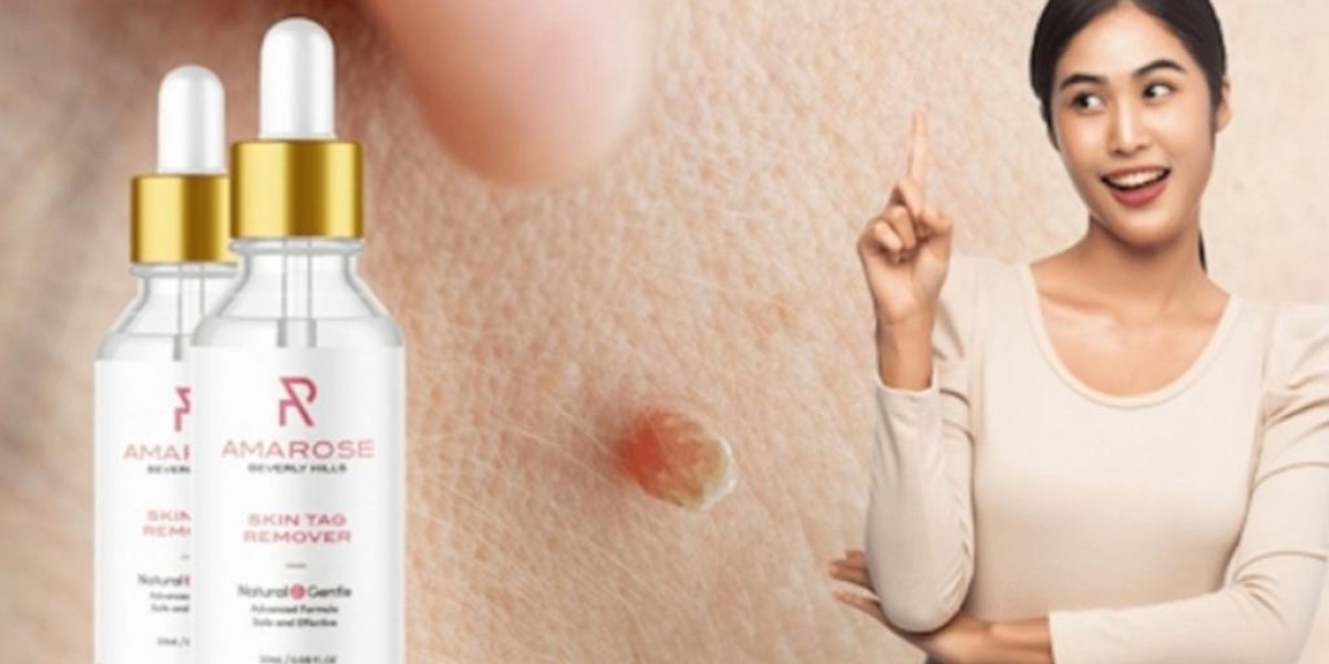 Amarose skin tag remover Where To Buy