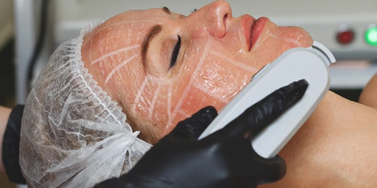 Rediscover Radiance: The Wonders of HIFU Treatment