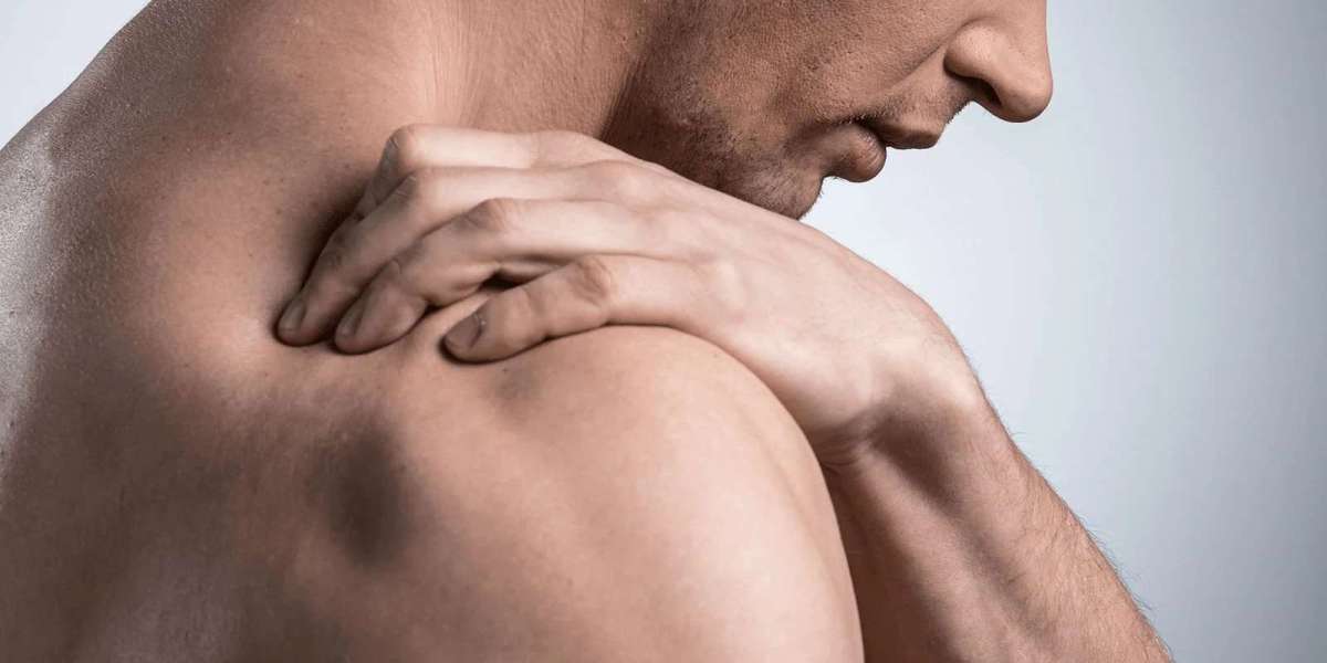 Unlocking Shoulder Health: Expert Solutions from Legend Physiotherapy for Rotator Cuff Tears and Injuries in Surrey