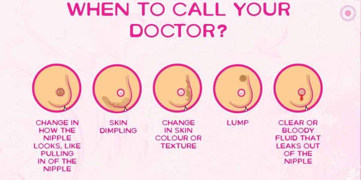 Nipple Discharge Treatment in Pune - Specialized Care by Dr. Shilpy Dolas