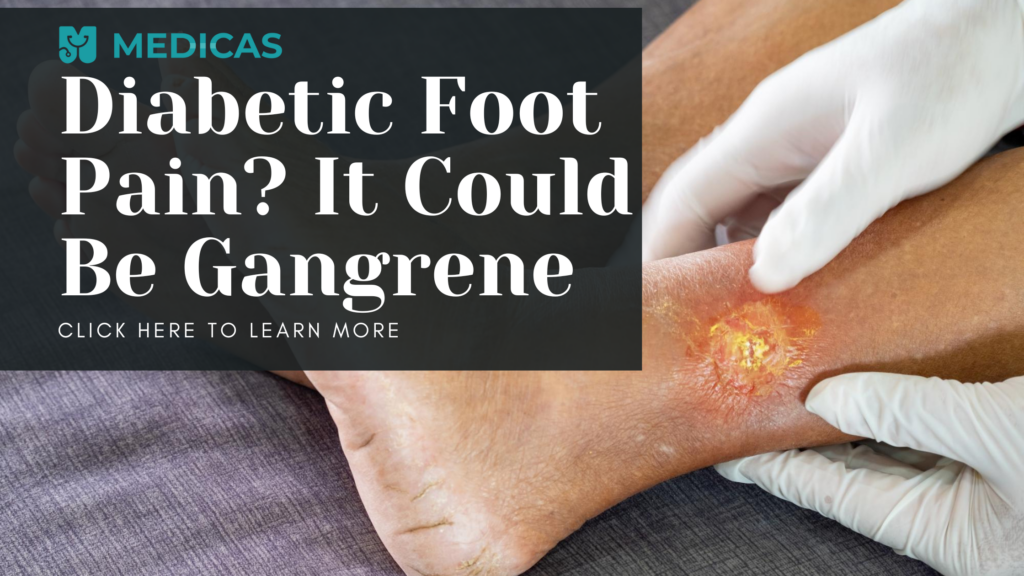 What is the Link between Gangrene and Diabetes? | Medicas