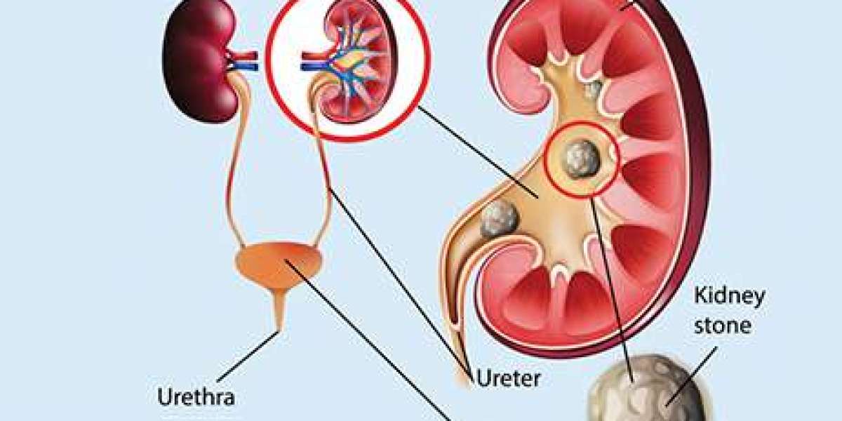 Best kidney specialist in bhosari - Swanand Kidney Clinic