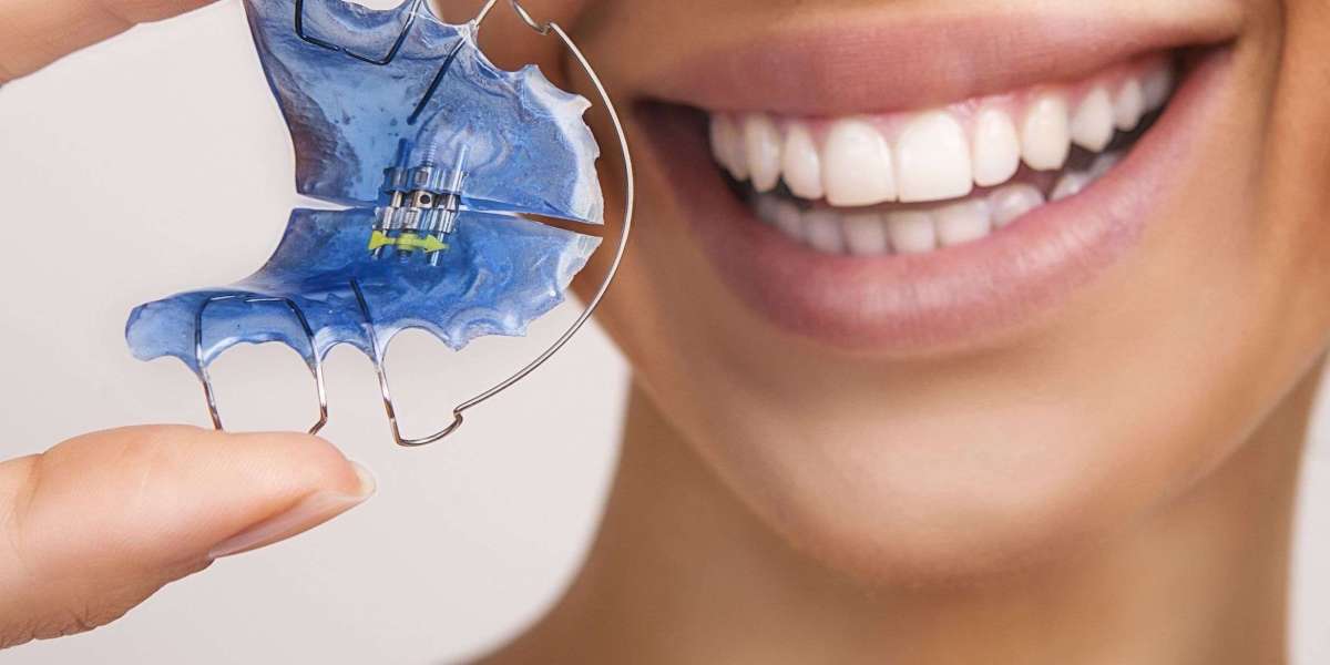 How to Clean Dental Retainers: A Complete Guide