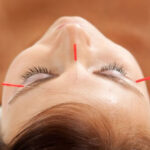 How Cosmetic Acupuncture Promotes Holistic Beauty and Wellness