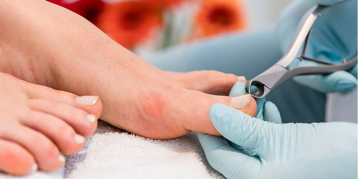 How to Use Nail Scissors for Ingrown Toenails to Prevent Issues