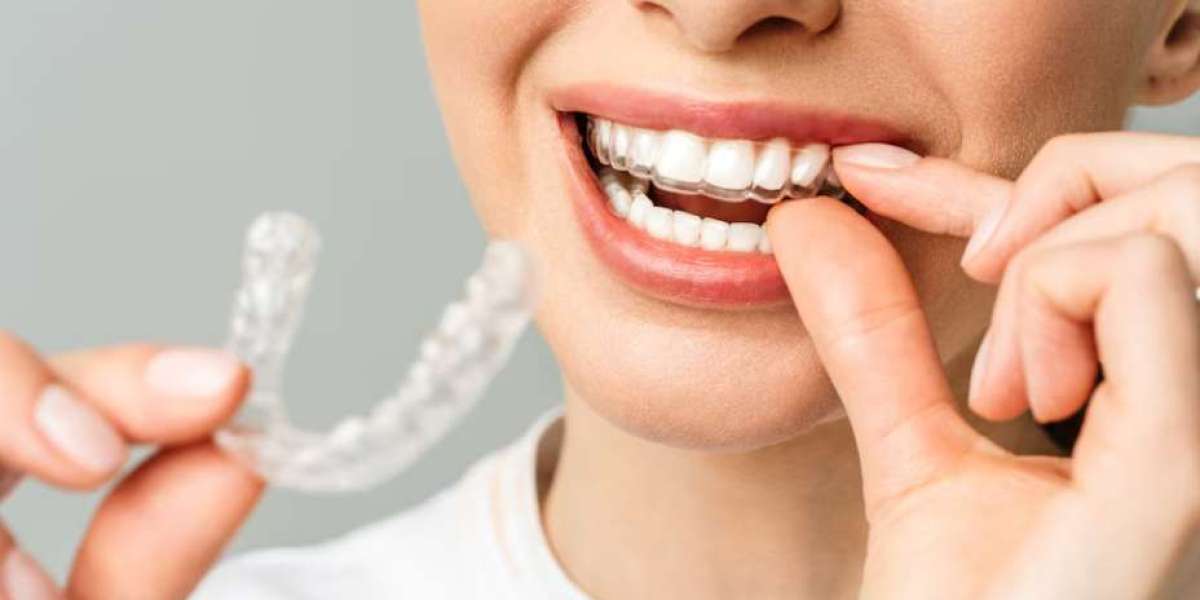 What Can I Expect in Invisalign Treatment?