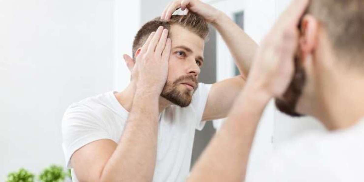 How Testosterone Impacts Hair Growth and Loss?