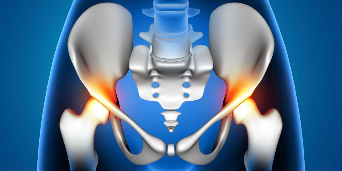 Osteoporosis-Related Fractures: Causes, Symptoms & Treatment