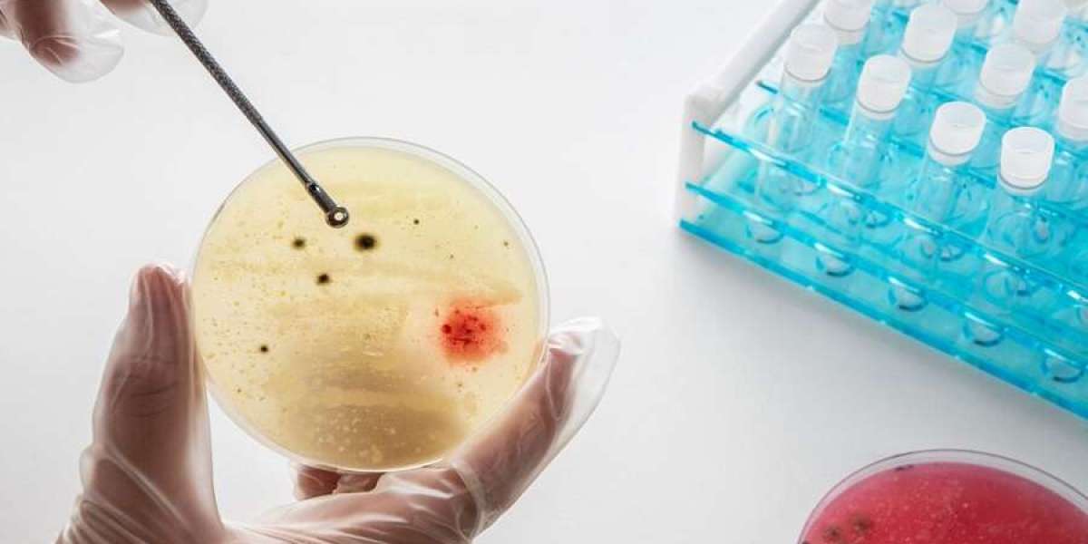 Immunohistochemistry Market Demand Worldwide in 2025, by Region to 2032