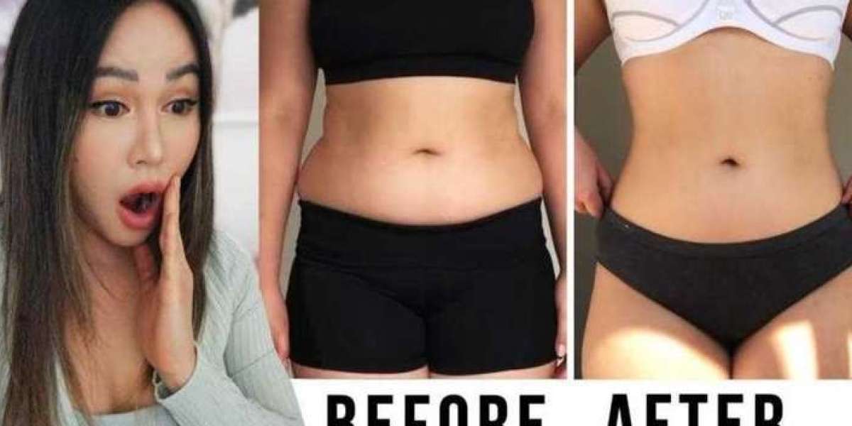 Valiant Keto ACV Gummies Consumer Reports-{BEST PRICE}-ACV + Keto = Magic? What You Need to Know About Valiant Gummies!