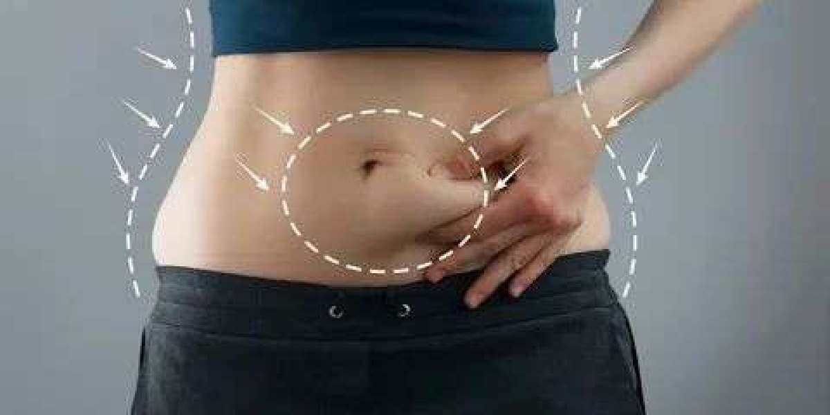 What areas can be treated with liposuction in Philadelphia?