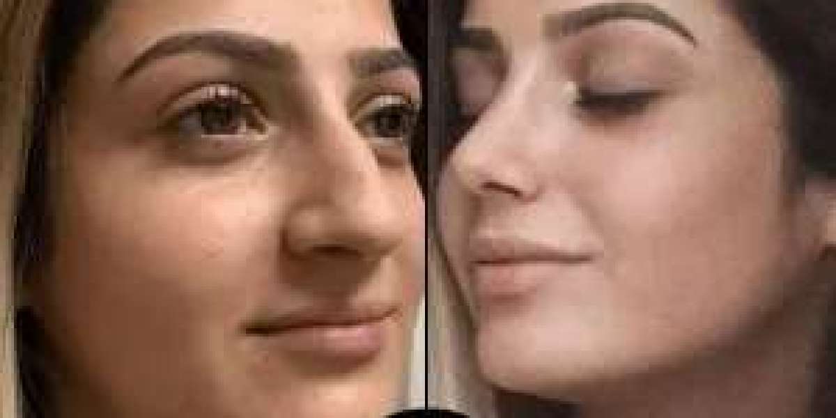 PRP Treatment in Dubai for Skin Rejuvenation: Restore Your Youth