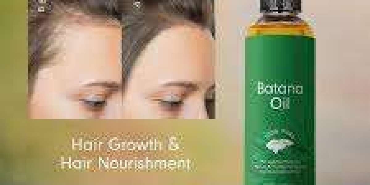Understanding the Early Signs of Hair Loss and How to Act Quickly
