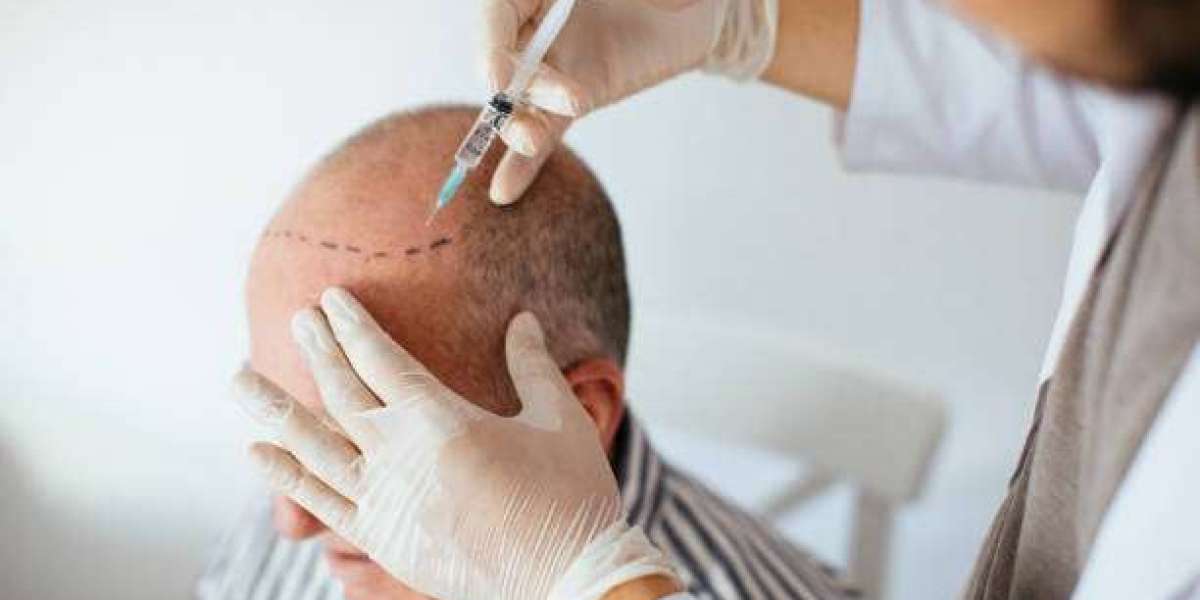 Innovative Stem Cell Solutions for Hair Restoration